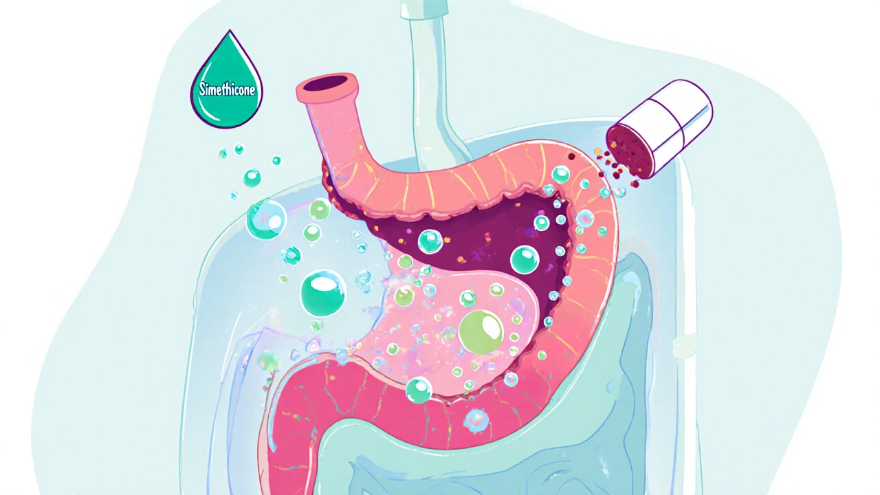 Cartoon cross‑section of stomach showing simethicone merging gas bubbles and a dissolving tablet.